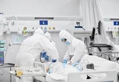 Koronavirüs geçirenler dikkat! Akciğer mantarı veremi aktif hale getiriyor!