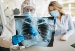 COVİD-19 sonrası kalbe ve akciğerlere dikkat!