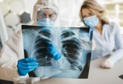 Akciğer nasıl temizlenir? Akciğerleri temizleyen besinler nelerdir? İşte cevabı...