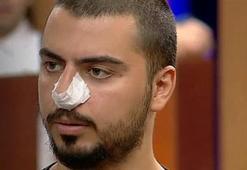 MasterChef Serhat'ın burnuna ne oldu? Herkes merak ediyor...