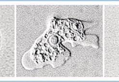 Beyin yiyen amip paniği