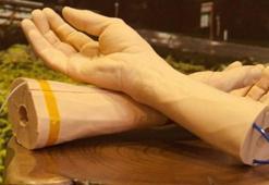 Google kanseri erken teşhis edecek bir bileklik geliştiriyor