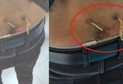 Çamaşır ipiyle tedavi adı altında işkence!