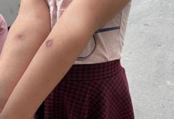 Korkutan Asya Kaplan Sivrisineği uyarısı! Giyside bile...