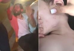 Bebeğine işkence yaptığı iddia edilen babaya meydan dayağı!