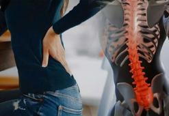 15 dakikada birçok omurga problemi giderilebiliyor