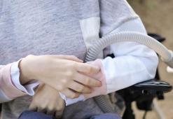 Dünyada her 30 kişiden 1’i SMA taşıyıcısı!