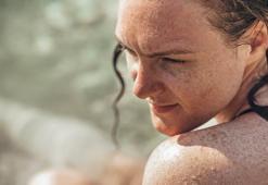 Güneş lekelerinden kurtulmanın yolları!