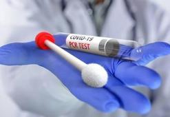 PCR testi nedir, nasıl yapılır, ücreti ne kadar? PCR testi zorunluluğu hangi alanlar için getirildi?