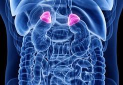 Addison hastalığı nedir, neden olur? Addison hastalığı tedavi edilmezse ne olur?