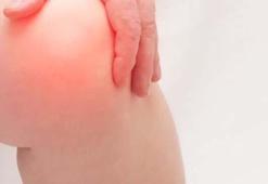 Fil hastalığı nedir, neden olur?