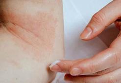 Stres egzaması belirtisi ve tedavi yöntemleri