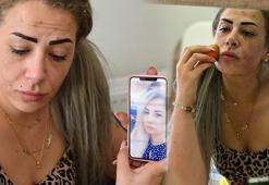 Güzellik merkezine gitti, kabusu yaşadı! 'Lüks mekan diye aldandım'