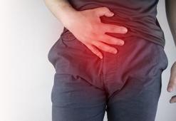 Kasık fıtığı çeşitleri nelerdir? Kasık fıtığının tedavi yöntemleri nelerdir?