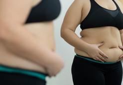 Mide balonunun avantajları nelerdir?