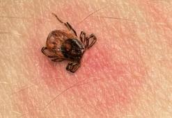 Lyme hastalığı nedir, belirtileri nelerdir? Lyme hastalığı nelere yol açar?