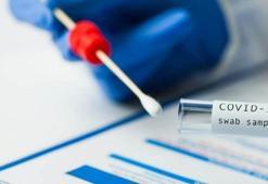 AVM PCR testi zorunlu mu? PCR testi nerelerde zorunlu? Negatif PCR testi zorunluluğu