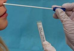 PCR testi ücretli mi? PCR testi nasıl yapılır, PCR testi için randevu gerekli mi?