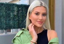 "‘Rus tekniği dudak dolgusu’ yaptırmak, pişman edebilir"