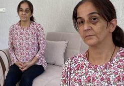 Eşinden yıllardır şiddet görüyor! 'Hamileyken bile dayak yedim'