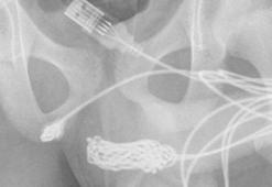'Ölçmek' için yaptı! Cinsel organından çıkan şey şok etti
