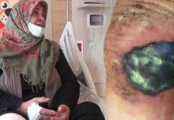 Toz haline getirip bacağına sardı! Hayatı karardı