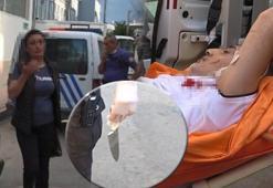 Kendisine şiddet uygulayan erkek arkadaşını bıçakladı!