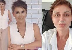 Serap Paköz estetik sonrası ilk kez paylaştı! Son hali...