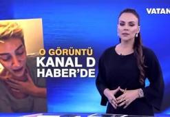 Sıla’nın olaydan 18 saat sonra çekilen görüntüsü!