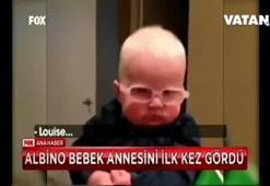 Annesini ilk kez gören albino bebeğin mutluluğu