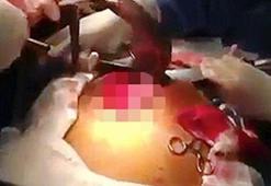 Bağırsaklarından canlı balık çıktı! (+18)