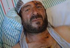 Yaylada birden üzerine atladı! Dehşet anlarını anlattı! Ayı saldırısı