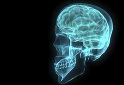 Kült kafa travması nedir? Esra Hankulu’nun ölüm sebebi kült (künt) kafa travması neden ve nasıl olur?