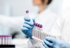 'Hematolojik kanserlerin tedavisinde yapay zeka devrede'