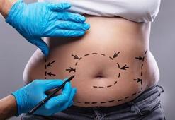 3D karın germe yönteminin avantajları nelerdir?