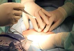 26 bin 894 kişi organ nakli bekliyor