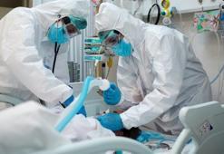 Tüm PCR testlerine ‘negatif’ dediler! Koronavirüs bu kez bağırsaklarda ortaya çıktı