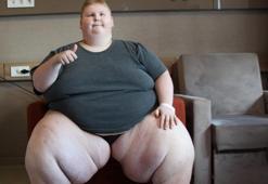 200 kilo olan İdil’e Türk hekimler umut oldu