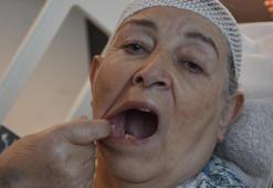 'Delirten hastalık'ta 5 dişinden oldu