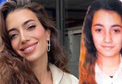 Rachel Araz 'estetik' iddiaları ile ilgili ilk kez konuştu!