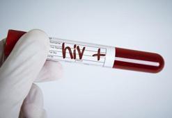 HIV virüsü tanıda geç kalınırsa AIDS’e dönüşüyor