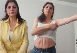 3 ameliyat geçirdi, estetik operasyonlar sonrası hayatı kabusa döndü!