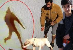 Pitbull saldırısı bitmek bilmiyor! 13 yaşındaki çocuğa zarar verdi!