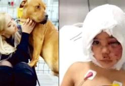 Asiye Ateş olayı ile ilgili skandal iddia! Pitbull saldırısı sonrası...