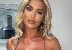 Love Island yıldızı itiraf etti! "Geçmişte onları hep dolguyla destekliyordum"