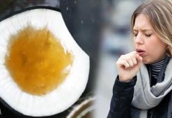 Öksürük için ilaç, tam bir doğal antibiyotik! Bal ile karıştırınca...