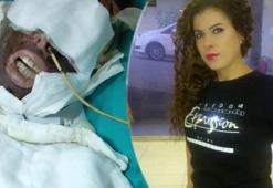 Avcılar'da sevgilisinin üzerine kimyasal madde döken saplantılı aşık için istenen ceza belli oldu