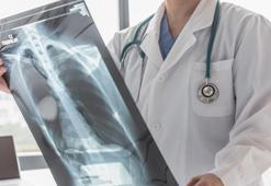 Verem hastalığı sinsi olsa da ilaçla tedavisi mümkün