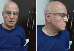 Hastanede akılalmaz olay! Randevu tarihini beğenmeyince doktoru yumrukladı