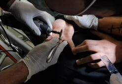 Parmağına 1 lira sıkışan çocuk böyle kurtarıldı
